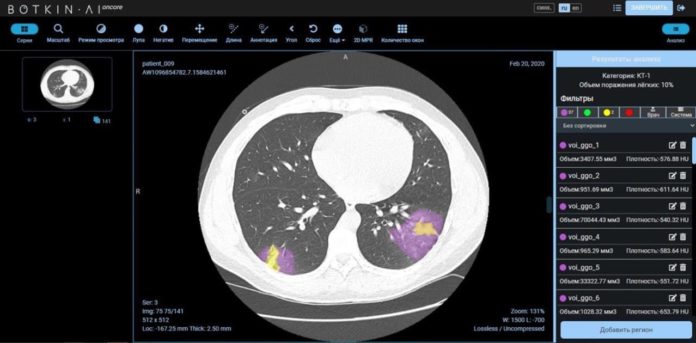 На платформе искусственного интеллекта Botkin.AI «Петровакс» и «Интеллоджик» запускают проект по исследованию препарата Лонгидаза®...