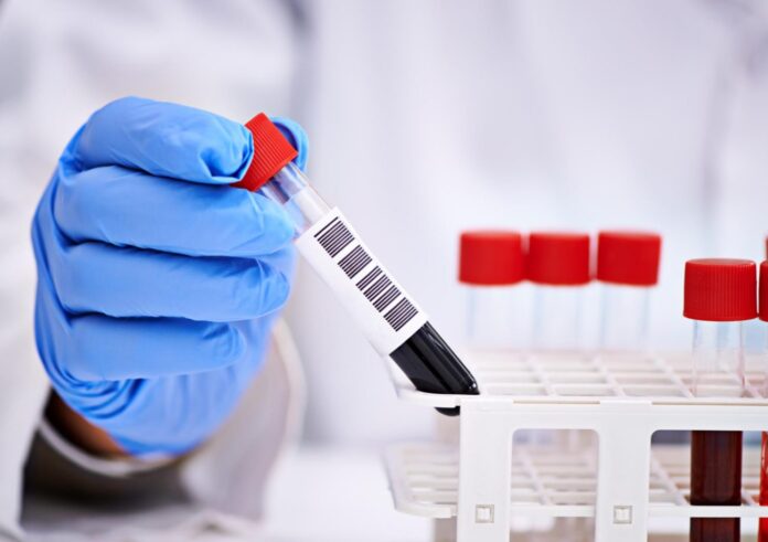 Предпринимателям Большого Подольска помогут снизить нагрузку при проведении сотрудникам тестирования на COVID-19