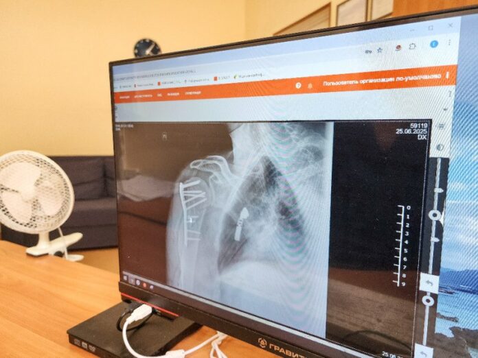 Врачи из Подольска проводят уникальные операции при переломах плеча